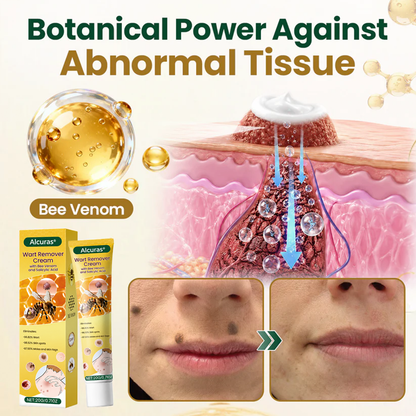 Alcuras® Wart Remover Cream with Bee Venom and Salicylic Acid – Skin Tag Removal & Skin Repair Formula for Face and Body