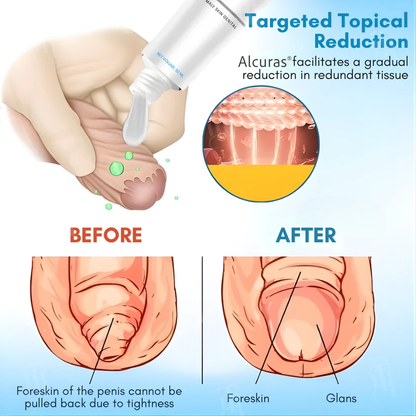 ⚡Alcuras® Foreskin Elasticity Gel: Restore Your Edge, Restart Your Vitality.