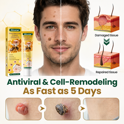 Alcuras® Wart Remover Cream with Bee Venom and Salicylic Acid – Skin Tag Removal & Skin Repair Formula for Face and Body