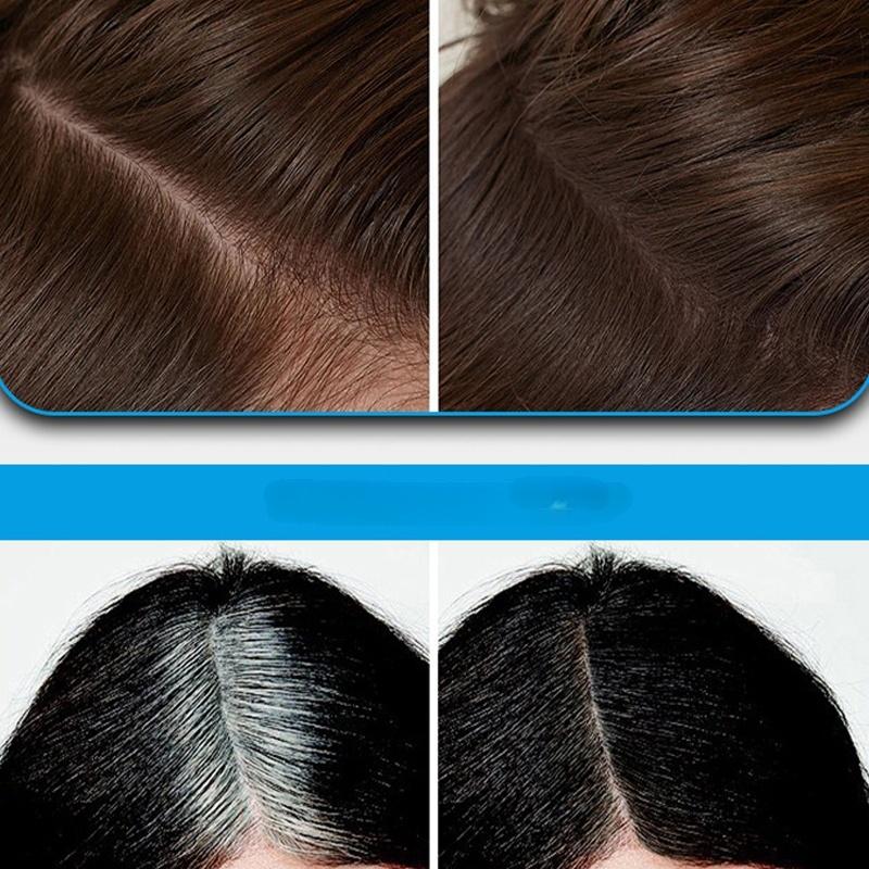 💖Multi-Functional Instant Concealer Hairline Powder